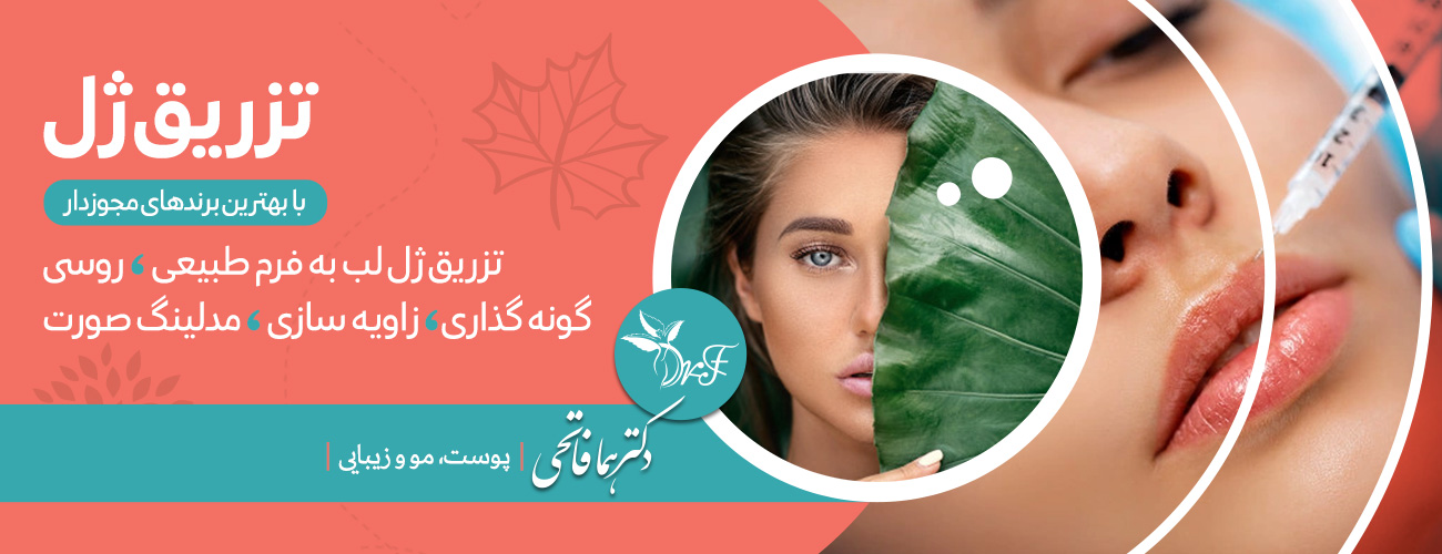 کات گونه با تزریق فیلر | تزرق ژل فرم قلبی و سیبی گونه